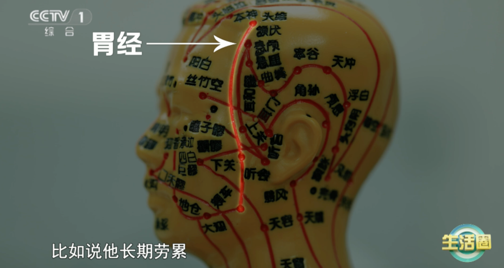 康问题 护发与健康小贴士快收藏冰球突破不同位置白发反映不同健(图3)